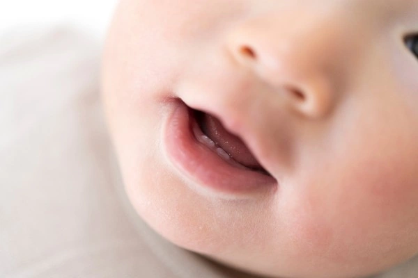 0歳の赤ちゃんの歯科診療