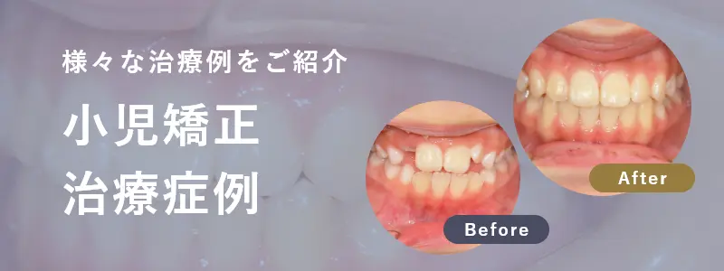症例集